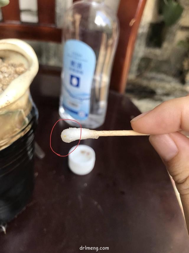 棉签+酒精处理蚧壳虫和枯叶示范图